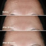 CLINIQUE SMART CLINICAL REPAIR 50ML – Image 2