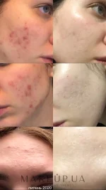 LA ROCHE POSAY EFFACLAR SERUM ULTRA CONCENTRE 30ML – Image 4